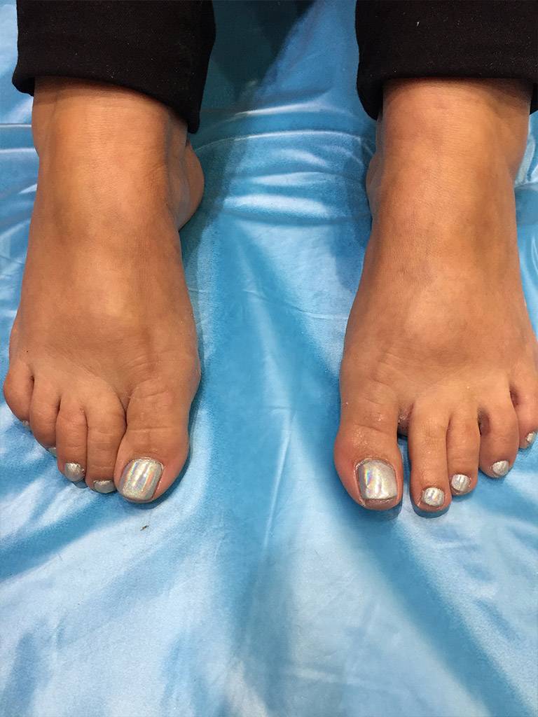 toe nail painting and treatment